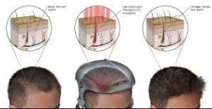 Hair root diagram