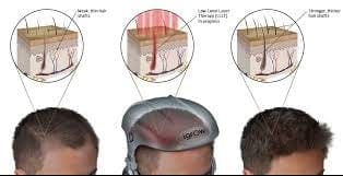 Hair root diagram
