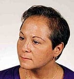 Hair loss of woman