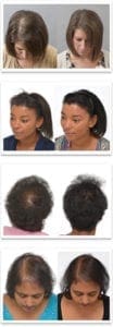 Before and after hair effect on women